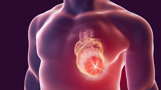 Clinical Trial Trends: Rare Cardiovascular