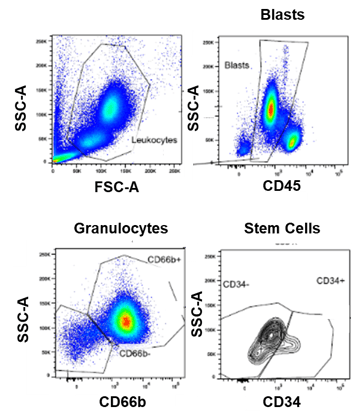 Representative RO analysis of fixed whole blood from a patient with AML using a 7-color flow cytometry panel