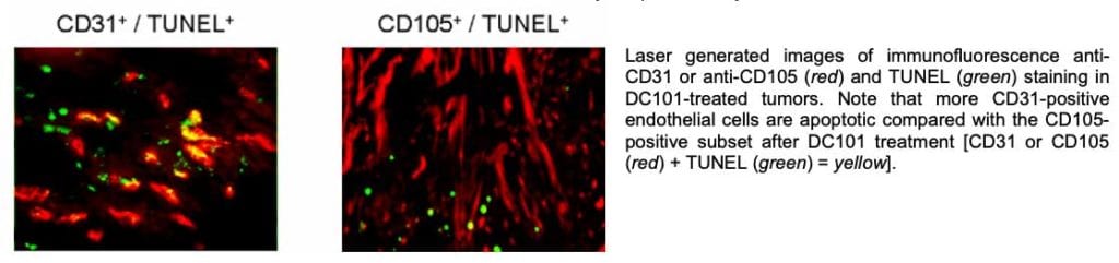 CD31-CD105-TUNEL-1024x241-1