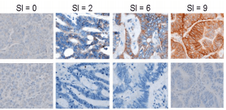 P-Cadherin_IHC_Staining